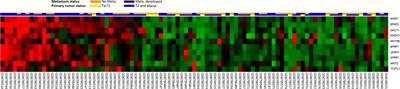 High Stromal SFRP2 Expression in Urothelial Carcinoma Confers an Unfavorable Prognosis